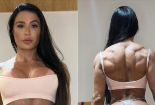 Gracyanne Barbosa mostra corpo após cirurgia delicada e desabafa: “Perdi massa muscular”
